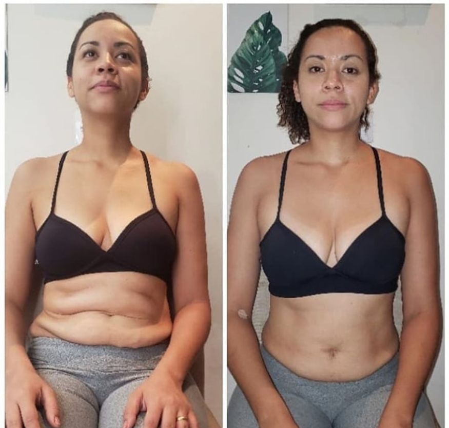 Antes e depois