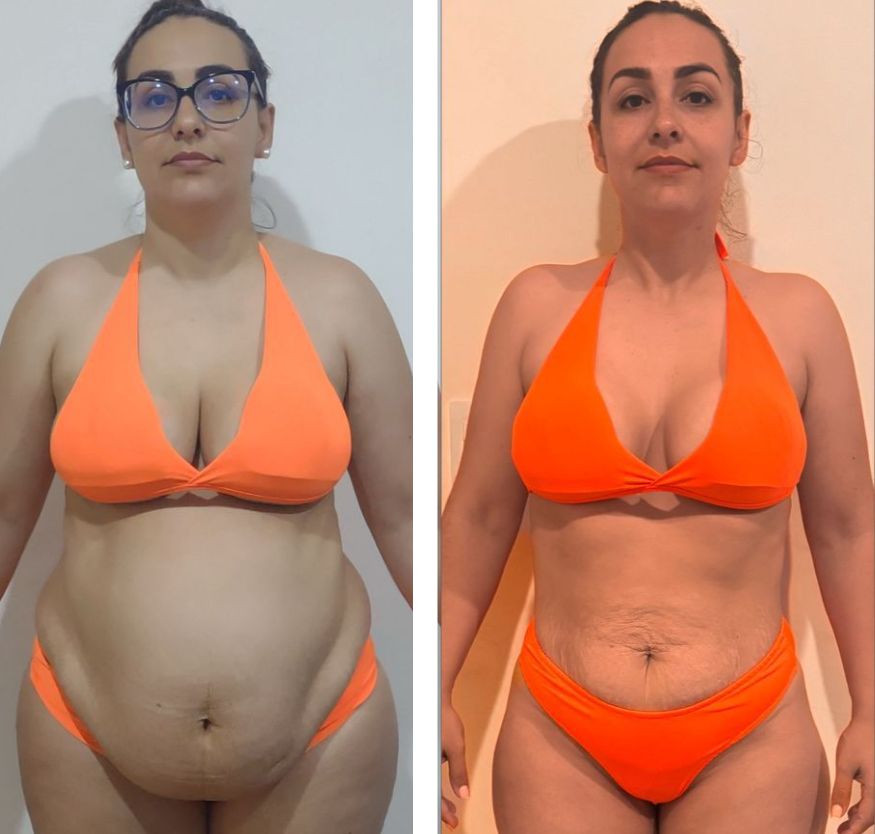 Antes e depois