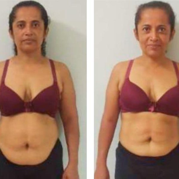 Antes e depois