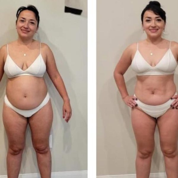 Antes e depois