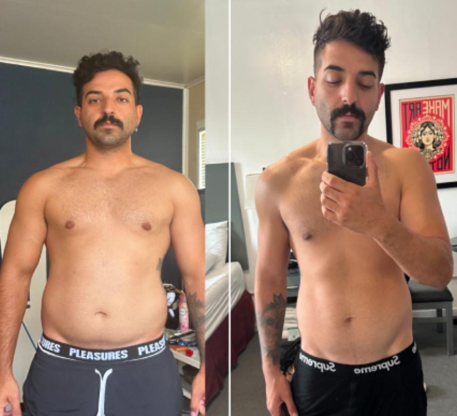 Antes e depois
