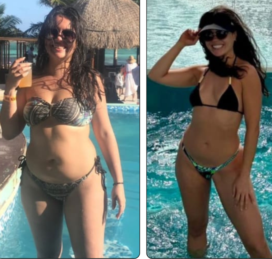Antes e depois