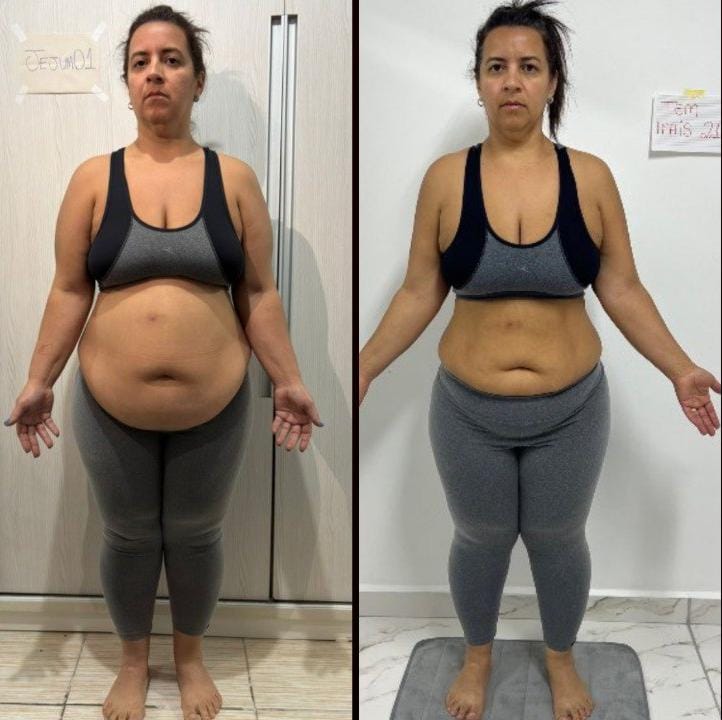 Antes e depois