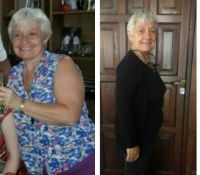Antes e depois
